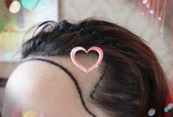 -大麦微针植发全国连锁