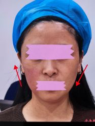 点击看大图 -Yestar 嘉兴艺星医疗美容医院