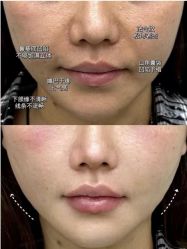 -云南吴氏嘉美医疗美容医院