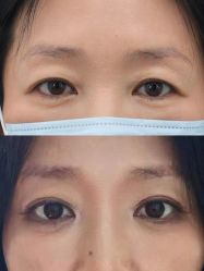 -丰联丽格医疗美容·联合丽格眼整形中心
