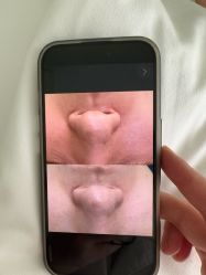 -苗医生0感祛痘连锁