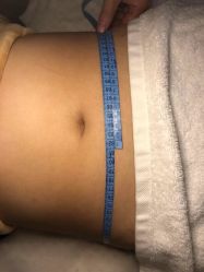 -肥三针腧穴瘦身馆