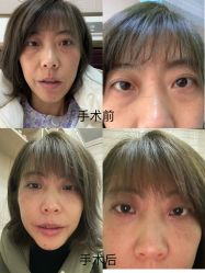 -南京医科大学友谊整形外科医院