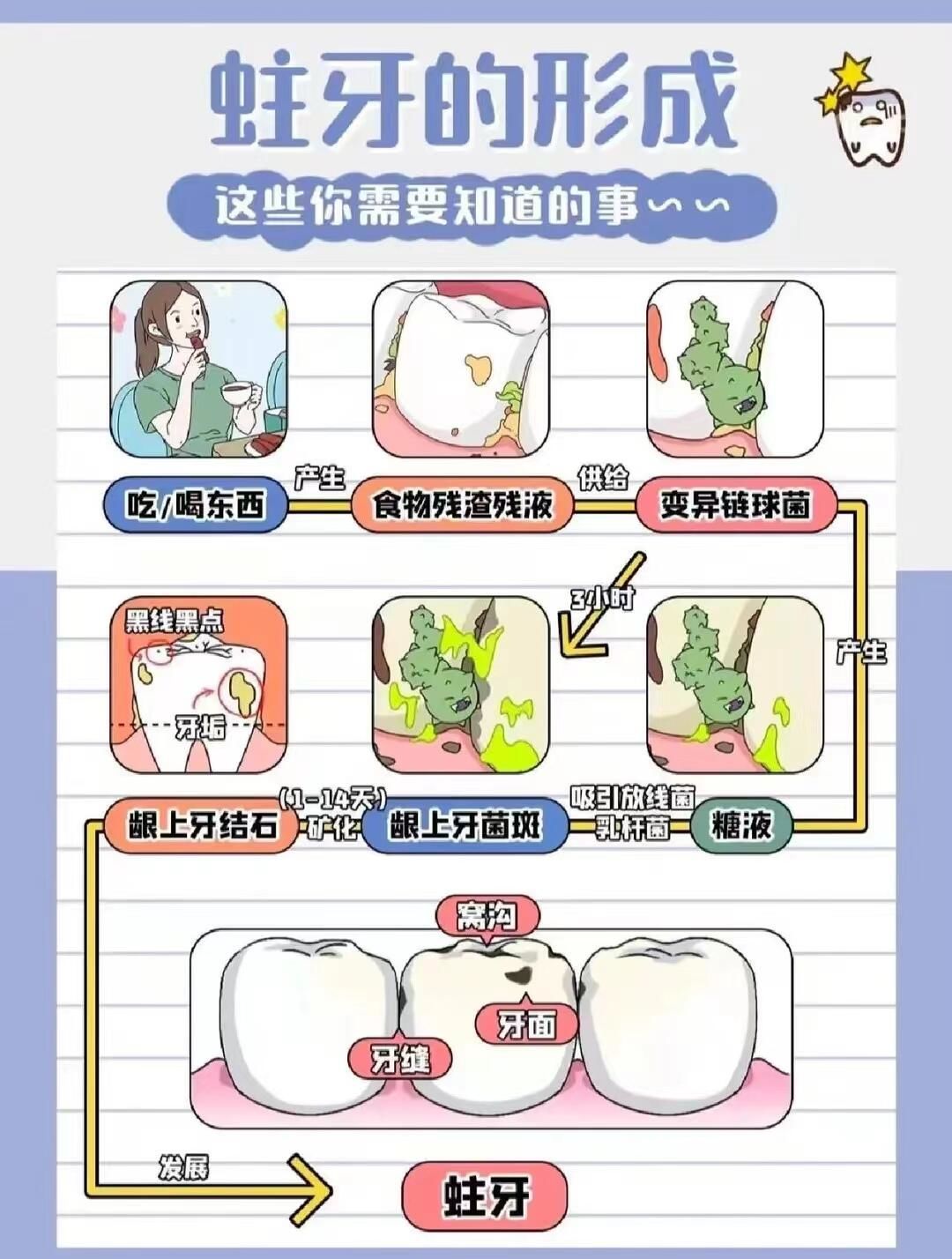 蛀牙的形成是一个复杂的过程,主要涉及四个关键