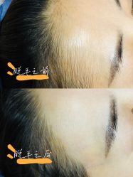 -薇兰专业脱毛连锁机构