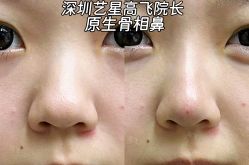 -深圳艺星医疗美容医院