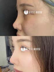 -北京米扬丽格医疗美容·联合丽格鼻整形中心