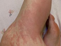 -无锡市第二人民医院(南院)