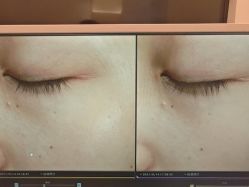 -苑苑vbeauty科技美容SPA