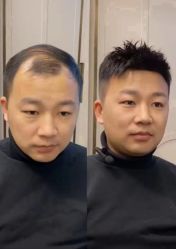 -唐风采假发补发定制