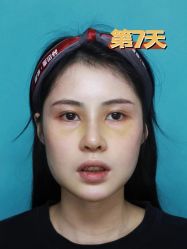 点击看大图 -深圳艺星医疗美容医院