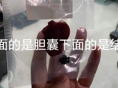 -中国人民解放军总医院(301医院)