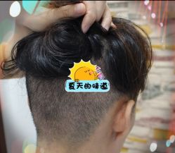 -大麦微针植发全国连锁