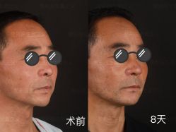 -北京米扬丽格医疗美容·联合丽格鼻整形中心