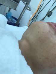 -痘庄科学祛痘国际连锁