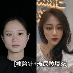 -Yestar艺星医疗美容医院