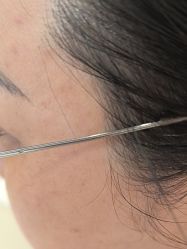 -广东韩妃整形外科医院