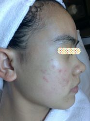 -皇族养心堂·净痘·修敏·御颜