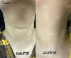 -Yestar艺星医疗美容医院