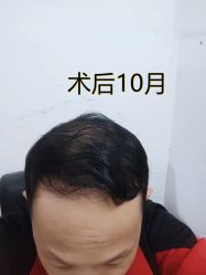 -雍禾植发全国连锁