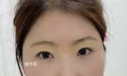 -MISS STAR·半永久纹眉·发际线·美瞳线