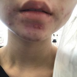 体验后-厦门美莱整形美容医院