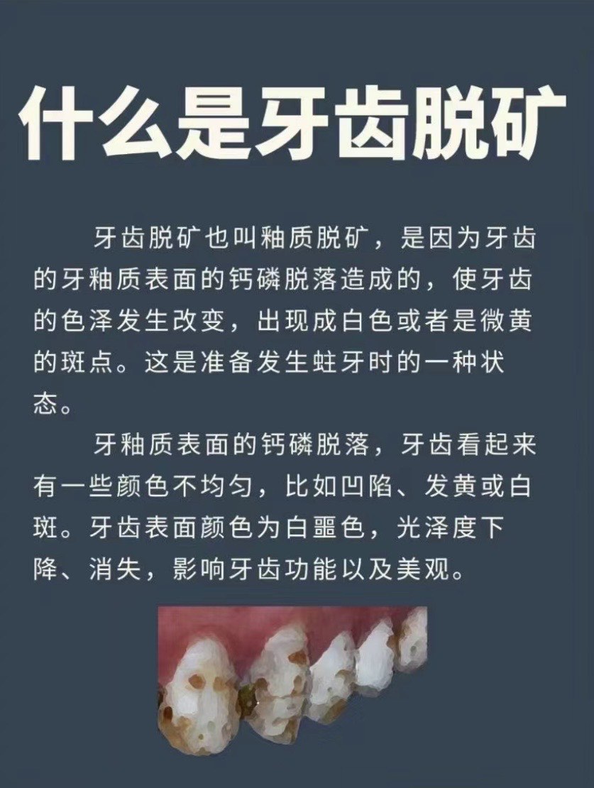 年轻人牙齿钙化的原因图片