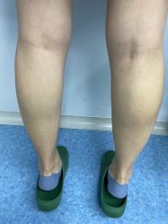 -郡艺医疗美容·微整·眼鼻吸脂