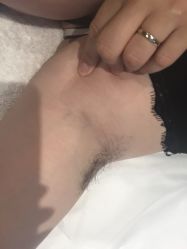 -觅屿日式脱毛美肤