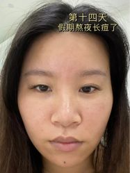 -Yestar宁波艺星整形医院
