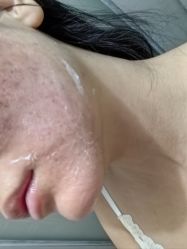 体验后-深圳医恒美医疗美容