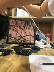 -章光101养发生发防脱发