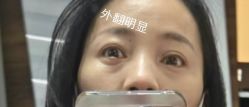 -上海时光整形外科医院