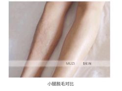 点击看大图 -木子美学