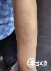 -雲艺刺青·洗纹身