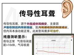 -宁耳听力助听器奥迪康峰力西门子斯达克(静安闸北店)