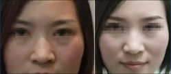 QQ截图20150812110744-太原丽都医疗美容医院
