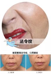 -兰派国际美容养生SPA