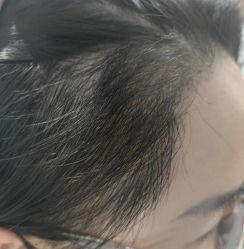 -万州华美紫馨整形美容医院