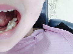-美酷口腔牙齿矫正(江桥万达店)