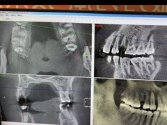 -土豆口腔(凤凰北总店)