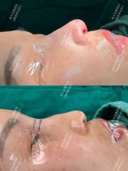 -北京米扬丽格医疗美容·联合丽格鼻整形中心