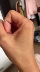 -天道专业洗纹身