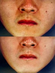 -和颜一美轻医美连锁