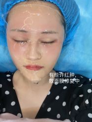 体验后-安徽合肥韩美整形外科医院