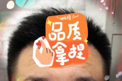 -大麦微针植发全国连锁