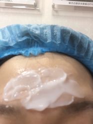 体验前-紫洁俪方（北京）医疗美容