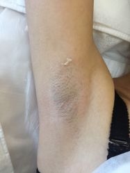 -VON半永久眉学设计