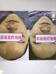 点击看大图 -SKIN79皮肤管理中心