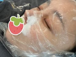 体验前-More摩尔医美の注射线雕光电中心